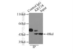 Cytokeratin 18 Rabbit anti-Human, Mouse, Polyclonal, Proteintech:Antibodies:Primary