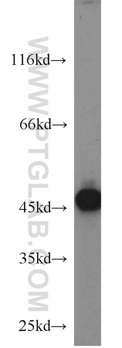 Cytokeratin 18 Rabbit anti-Human, Mouse, Polyclonal, Proteintech:Antibodies:Primary