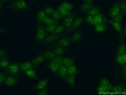 LSM4 Rabbit anti-Human, Mouse, Rat, Polyclonal, Proteintech:Antibodies:Primary