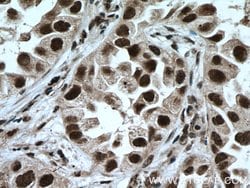 LSM4 Rabbit anti-Human, Mouse, Rat, Polyclonal, Proteintech:Antibodies:Primary