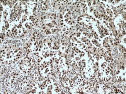 LSM4 Rabbit anti-Human, Mouse, Rat, Polyclonal, Proteintech:Antibodies:Primary
