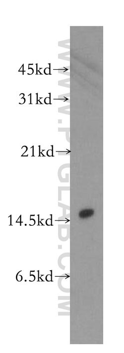 LSM4 Rabbit anti-Human, Mouse, Rat, Polyclonal, Proteintech:Antibodies:Primary