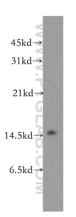LSM4 Rabbit anti-Human, Mouse, Rat, Polyclonal, Proteintech:Antibodies:Primary