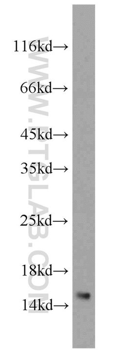 LSM4 Rabbit anti-Human, Mouse, Rat, Polyclonal, Proteintech:Antibodies:Primary