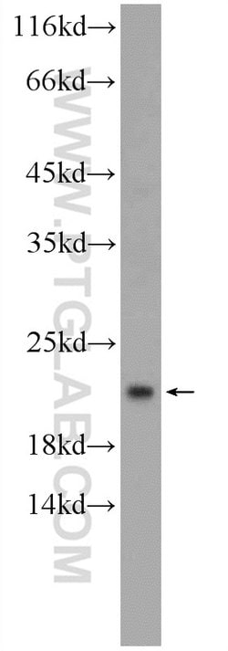 RAP1B Rabbit anti-Human, Mouse, Rat, Polyclonal, Proteintech:Antibodies:Primary