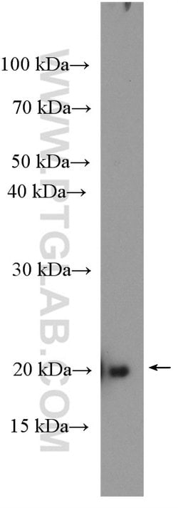 RAP1B Rabbit anti-Human, Mouse, Rat, Polyclonal, Proteintech:Antibodies:Primary