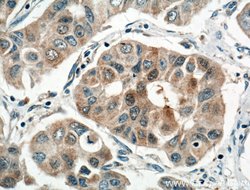 NOL3 Rabbit anti-Human, Mouse, Rat, Polyclonal, Proteintech 150 &mu;L;