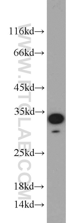 NOL3 Rabbit anti-Human, Mouse, Rat, Polyclonal, Proteintech 150 &mu;L;