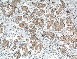 NOL3 Rabbit anti-Human, Mouse, Rat, Polyclonal, Proteintech 150 &mu;L;