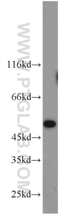 MST4 Rabbit anti-Human, Mouse, Rat, Polyclonal, Proteintech:Antibodies:Primary