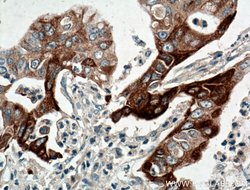 JP45/JSRP1 Rabbit anti-Human, Polyclonal, Proteintech 150 &mu;L; Unconjugated:Antibodies,