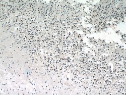 MECP2 Rabbit anti-Human, Mouse, Rat, Polyclonal, Proteintech 150 &mu;L;