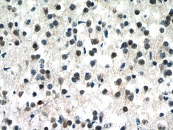 MECP2 Rabbit anti-Human, Mouse, Rat, Polyclonal, Proteintech 150 &mu;L;