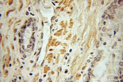 MECP2 Rabbit anti-Human, Mouse, Rat, Polyclonal, Proteintech 150 &mu;L;
