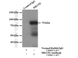 MECP2 Rabbit anti-Human, Mouse, Rat, Polyclonal, Proteintech 150 &mu;L;