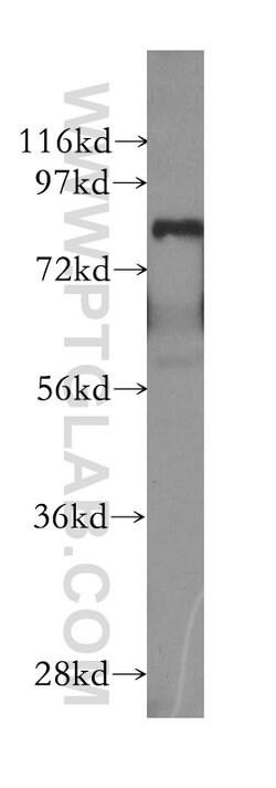 MECP2 Rabbit anti-Human, Mouse, Rat, Polyclonal, Proteintech 150 &mu;L;