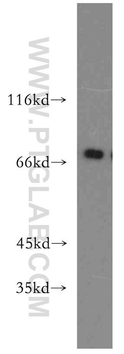 MECP2 Rabbit anti-Human, Mouse, Rat, Polyclonal, Proteintech 150 &mu;L;