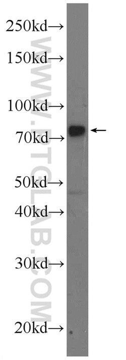 MECP2 Rabbit anti-Human, Mouse, Rat, Polyclonal, Proteintech 150 &mu;L;