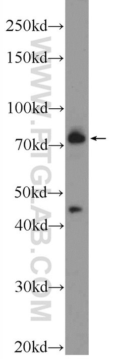 MECP2 Rabbit anti-Human, Mouse, Rat, Polyclonal, Proteintech 150 &mu;L;
