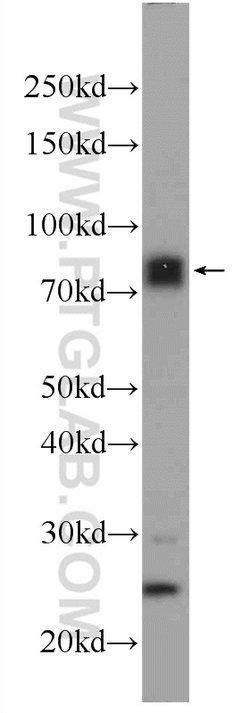 MECP2 Rabbit anti-Human, Mouse, Rat, Polyclonal, Proteintech 150 &mu;L;
