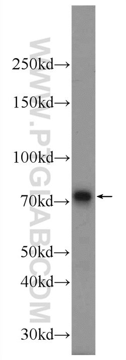 MECP2 Rabbit anti-Human, Mouse, Rat, Polyclonal, Proteintech 150 &mu;L;