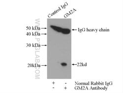 GM2A Rabbit anti-Human, Mouse, Rat, Polyclonal, Proteintech 150 &mu;L;