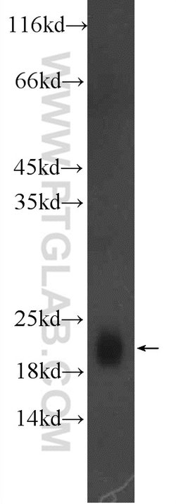 GM2A Rabbit anti-Human, Mouse, Rat, Polyclonal, Proteintech 150 &mu;L;