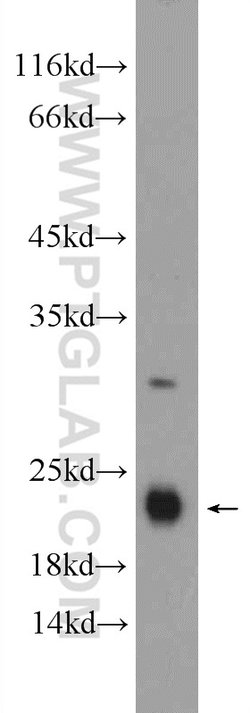 GM2A Rabbit anti-Human, Mouse, Rat, Polyclonal, Proteintech 150 &mu;L;