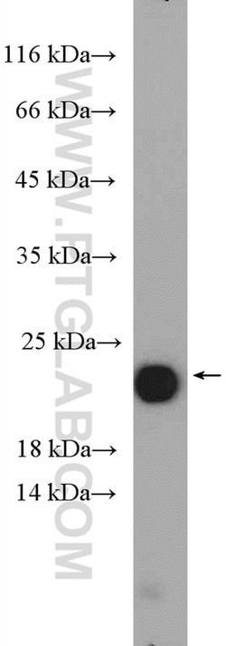 GM2A Rabbit anti-Human, Mouse, Rat, Polyclonal, Proteintech 150 &mu;L;