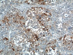 PRELID1 Rabbit anti-Human, Mouse, Rat, Polyclonal, Proteintech 150 &mu;L;