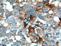PRELID1 Rabbit anti-Human, Mouse, Rat, Polyclonal, Proteintech 150 &mu;L;