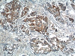 PRELID1 Rabbit anti-Human, Mouse, Rat, Polyclonal, Proteintech 150 &mu;L;