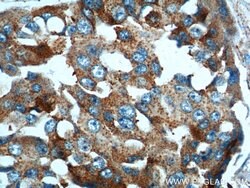 PRELID1 Rabbit anti-Human, Mouse, Rat, Polyclonal, Proteintech 150 &mu;L;