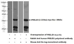 PRELID1 Rabbit anti-Human, Mouse, Rat, Polyclonal, Proteintech 150 &mu;L;