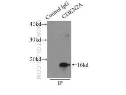 P16-INK4A Rabbit anti-Human, Polyclonal, Proteintech 150 &mu;L; Unconjugated:Antibodies,