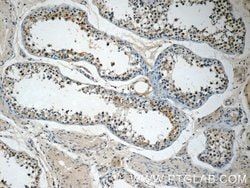 ETF1 Rabbit anti-Human, Mouse, Polyclonal, Proteintech:Antibodies:Primary