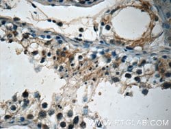 ETF1 Rabbit anti-Human, Mouse, Polyclonal, Proteintech:Antibodies:Primary