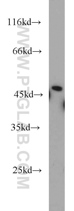 ETF1 Rabbit anti-Human, Mouse, Polyclonal, Proteintech:Antibodies:Primary