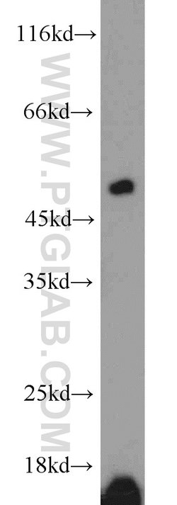 ETF1 Rabbit anti-Human, Mouse, Polyclonal, Proteintech:Antibodies:Primary