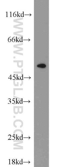 ETF1 Rabbit anti-Human, Mouse, Polyclonal, Proteintech:Antibodies:Primary