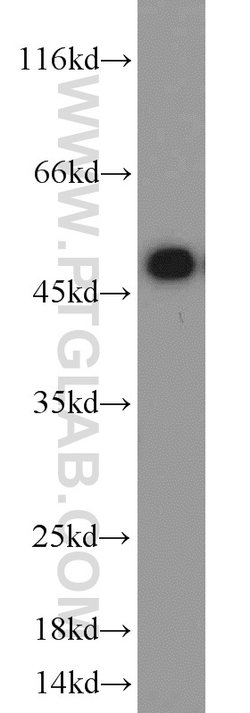 ETF1 Rabbit anti-Human, Mouse, Polyclonal, Proteintech:Antibodies:Primary