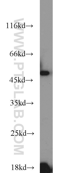 ETF1 Rabbit anti-Human, Mouse, Polyclonal, Proteintech:Antibodies:Primary