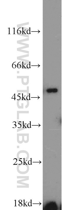ETF1 Rabbit anti-Human, Mouse, Polyclonal, Proteintech:Antibodies:Primary