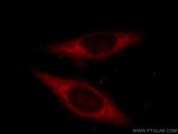 ETF1 Rabbit anti-Human, Mouse, Polyclonal, Proteintech:Antibodies:Primary