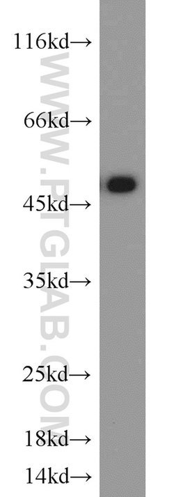 ETF1 Rabbit anti-Human, Mouse, Polyclonal, Proteintech:Antibodies:Primary