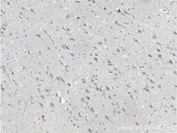 neuromedin B Rabbit anti-Human, Mouse, Rat, Polyclonal, Proteintech 150