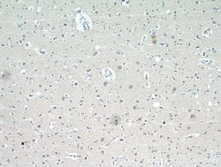 neuromedin B Rabbit anti-Human, Mouse, Rat, Polyclonal, Proteintech 150