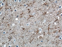 NPTX2 Rabbit anti-Human, Mouse, Rat, Polyclonal, Proteintech 150 &mu;L;