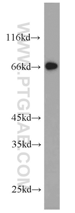 NPTX2 Rabbit anti-Human, Mouse, Rat, Polyclonal, Proteintech 150 &mu;L;