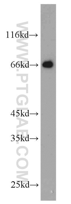 NPTX2 Rabbit anti-Human, Mouse, Rat, Polyclonal, Proteintech 150 &mu;L;